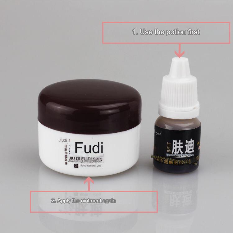 Травяной крем против укусов комаров и зуда кожи, местный крем против зуда