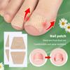 5Pairs Nail Care Patch Correction Patch Treatment Soft Nail Repair Patch Foot Care Tool