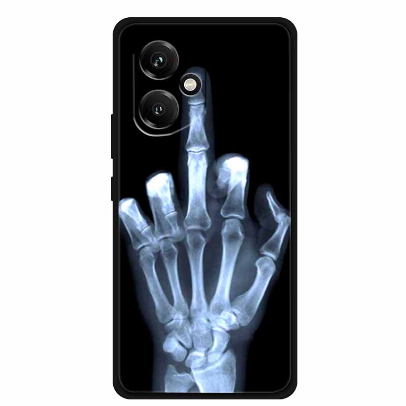 For Honor 400 5G Case Honor400 Phone Cover Wolf Lion Black Silicone Soft Coque For Honor 400 Pro 5G Back Cover Case Funda Shell