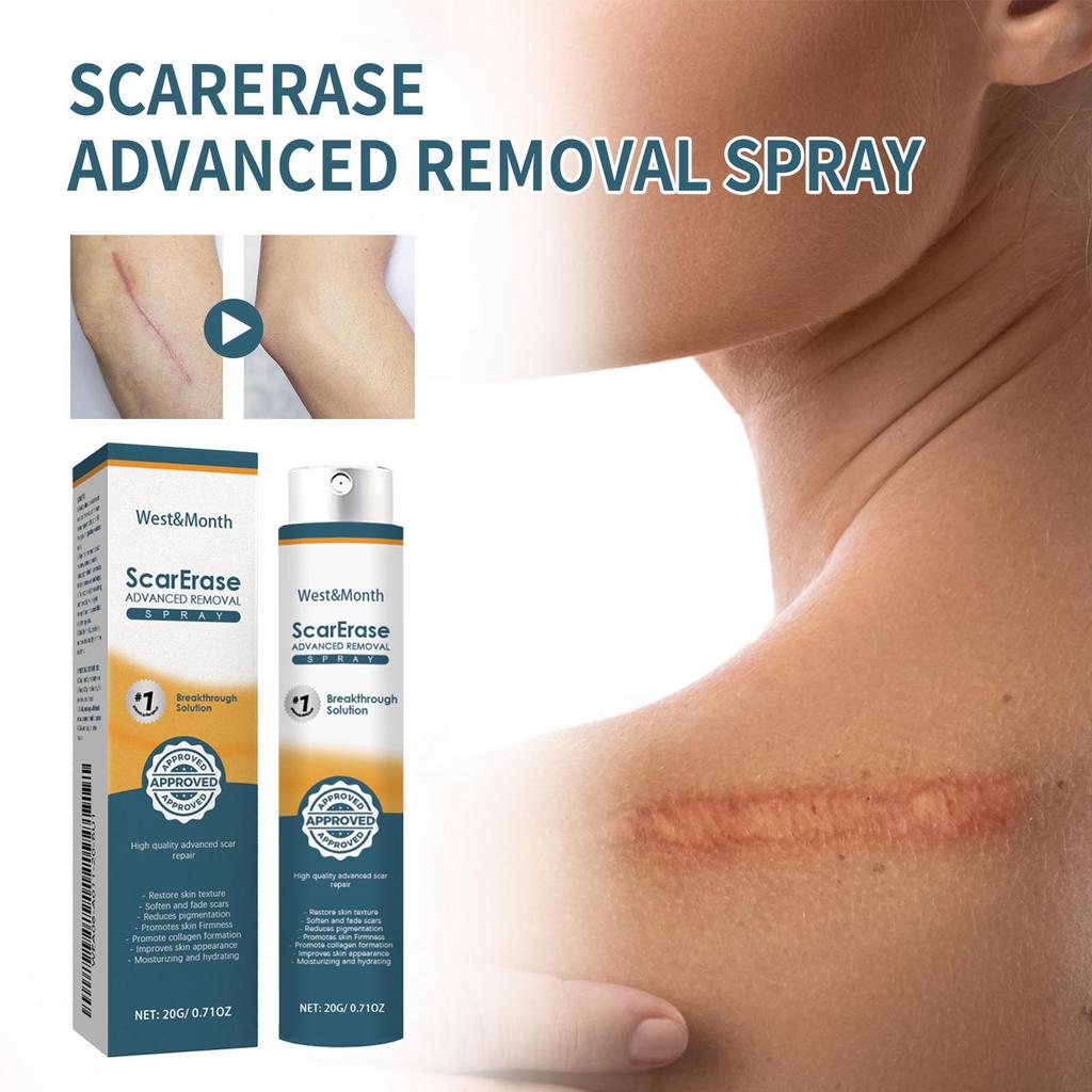 20 г West&Month Гель для восстановления рубцов Осветляющий Увлажняющий Восстанавливающий кожу Разглаживающий кожу Гель