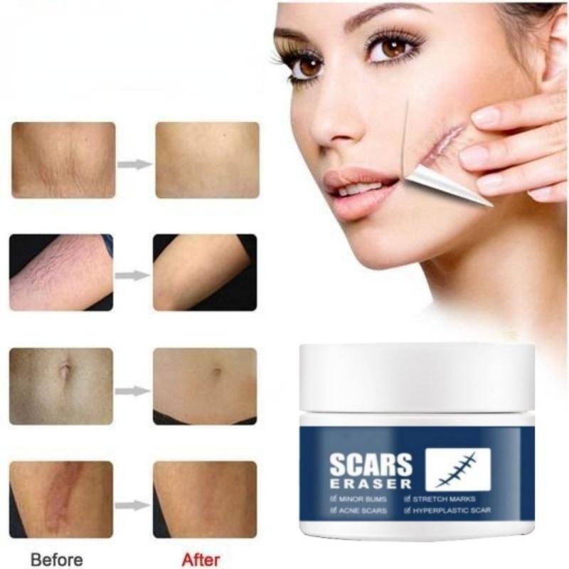 Не раздражающий восстанавливающий синтетический крем для удаления шрамов