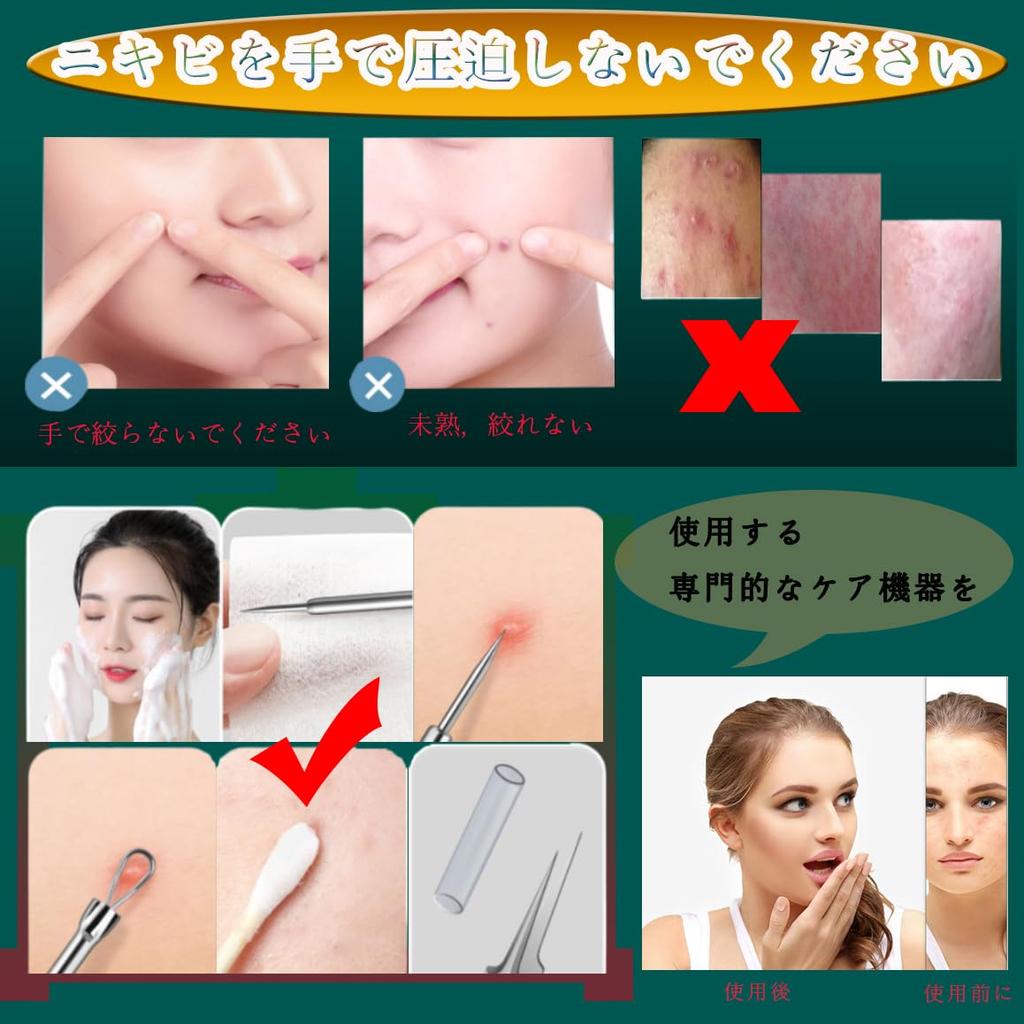 Blackhead Tweezers Set Precision Tweezers for Removing Powder and Perfect for Acne Stainless Tips for Blackhead Removal and Comedo Extraction -