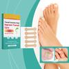 Nail Care Patches, Nail Correction, Comfortable Fit, Ingrown Nails, Improved Daily Fit, Convenient To Use, Gentle And Safe.