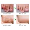 88g Anti Crack Moisturizing Hand Foot Cream Repairing Fissures Heal Ointment