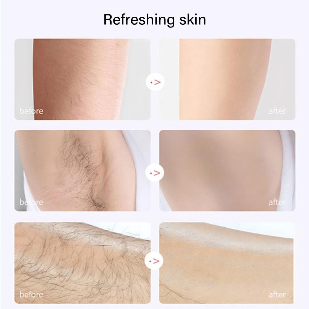 Электрический безболезненный эпилятор для женщин, перезаряжаемая бритва для удаления волос для ног, тела, лица, губ, подбородка, триммер для зоны бикини