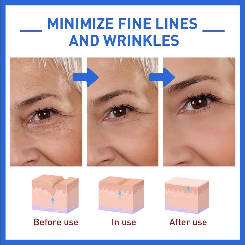 Collagen Anti-wrinkle Essence Reduces Facial Fine Lines and Wrinkles, Tightens Nasolabial Folds and Prevents Aging