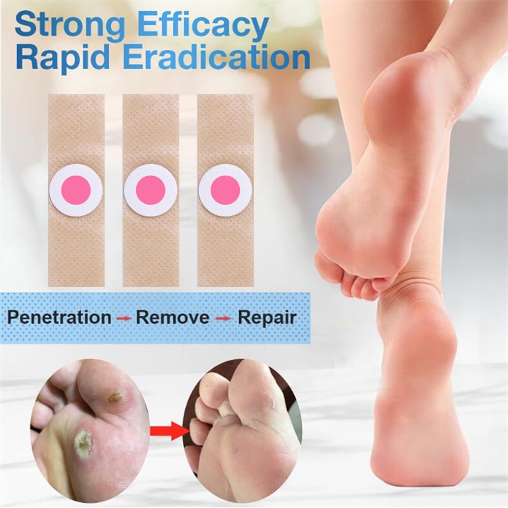 Foot Corn Removal Killer Calluses Plantar