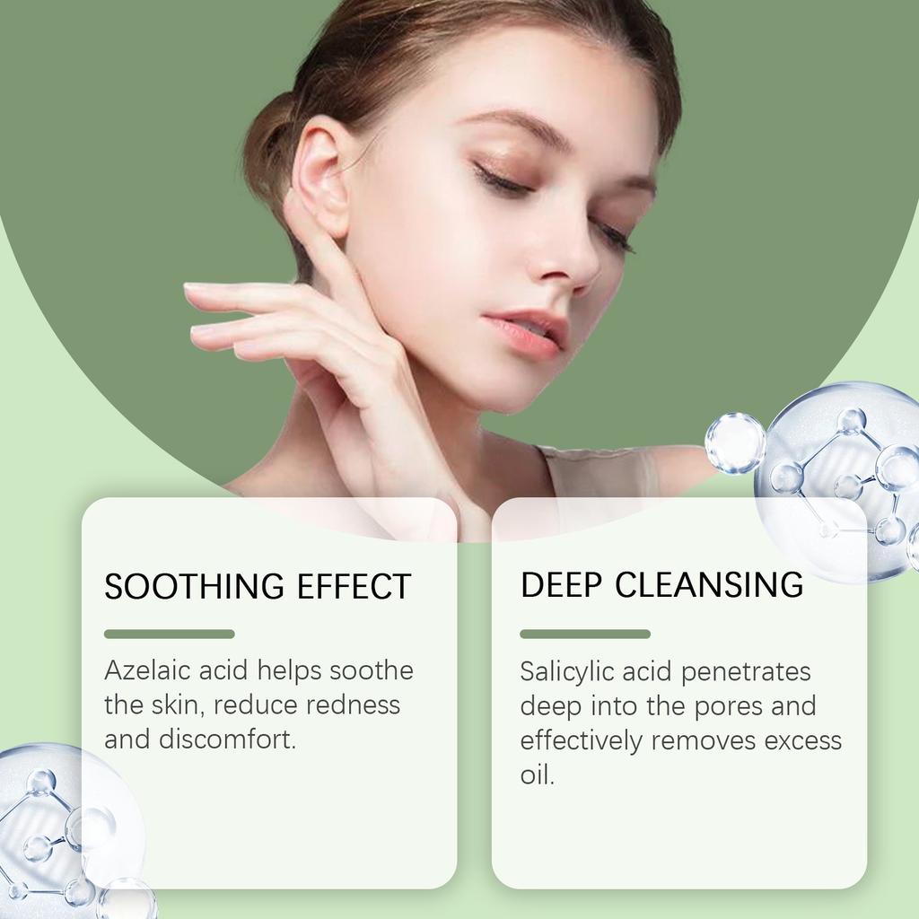 Крем для лица от прыщей, для лица и точек прыщей, натуральные растительные ингредиенты профессионально удаляют следы от прыщей, для подростков