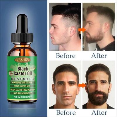 5 мл/15 мл/30 мл/50 мл/черное касторовое масло питает рост волос, массаж кожи, эфирное масло, рост бровей, предотвращает старение кожи, средства по уходу за волосами