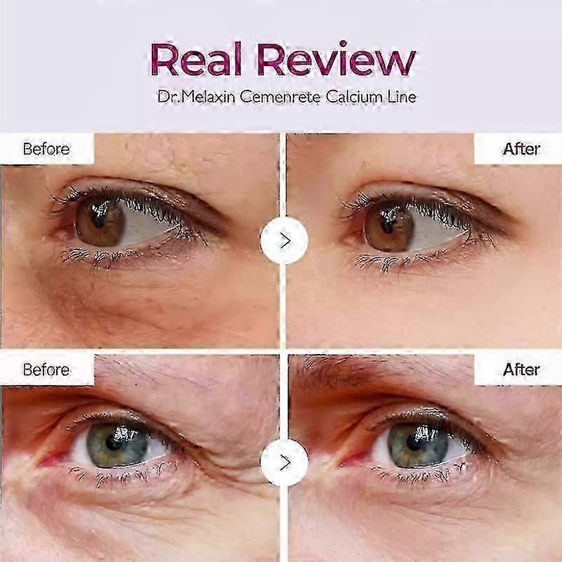 1-3x Dr.melaxin Anti-aging Eye Cream Cemenrete Calcium Volume Multi Balm Wrinkle Core Stick