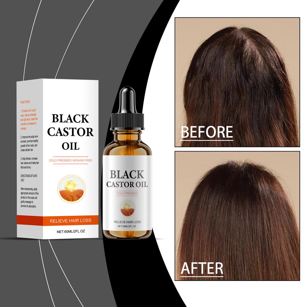 Черное касторовое масло для роста волос питает кожу головы и способствует здоровому росту волос и питательному уходу 60 мл