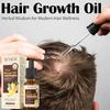 Имбирное масло для быстрого роста волос 20 мл Предотвращение выпадения волос Сыворотка для лечения кожи головы Разглаживание Восстановление поврежденных волос Укрепляющее масло Уход за волосами