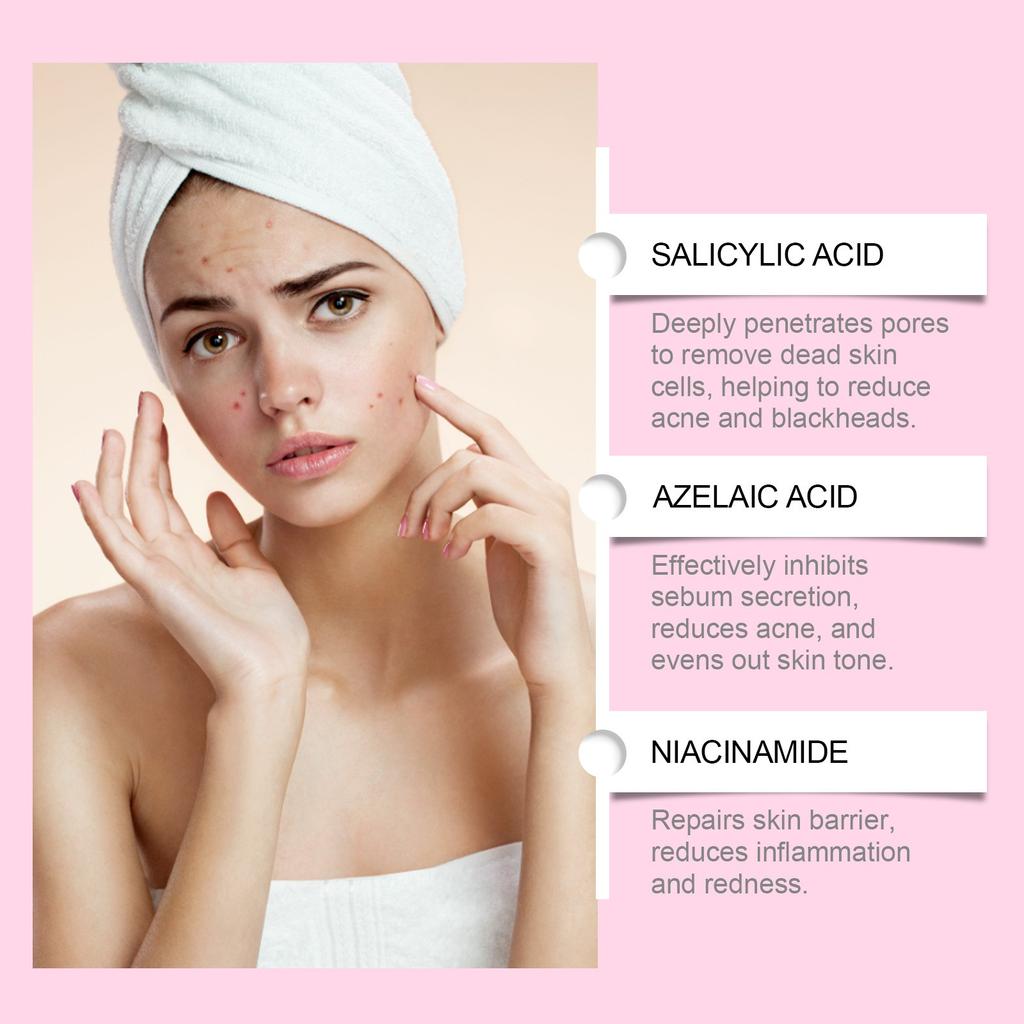 Facial Acne Cream, Repairing Facial Acne, Close The Mouth To Nourish Skin Tender And Smooth Skin Care Cream