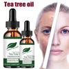 5 мл/15 мл/30 мл/50 мл/натуральное масло чайного дерева, увлажняющее, для лица, тела, женский уход за кожей, восстановление кожи, увлажняющее, ароматерапия, чистое массажное эфирное масло