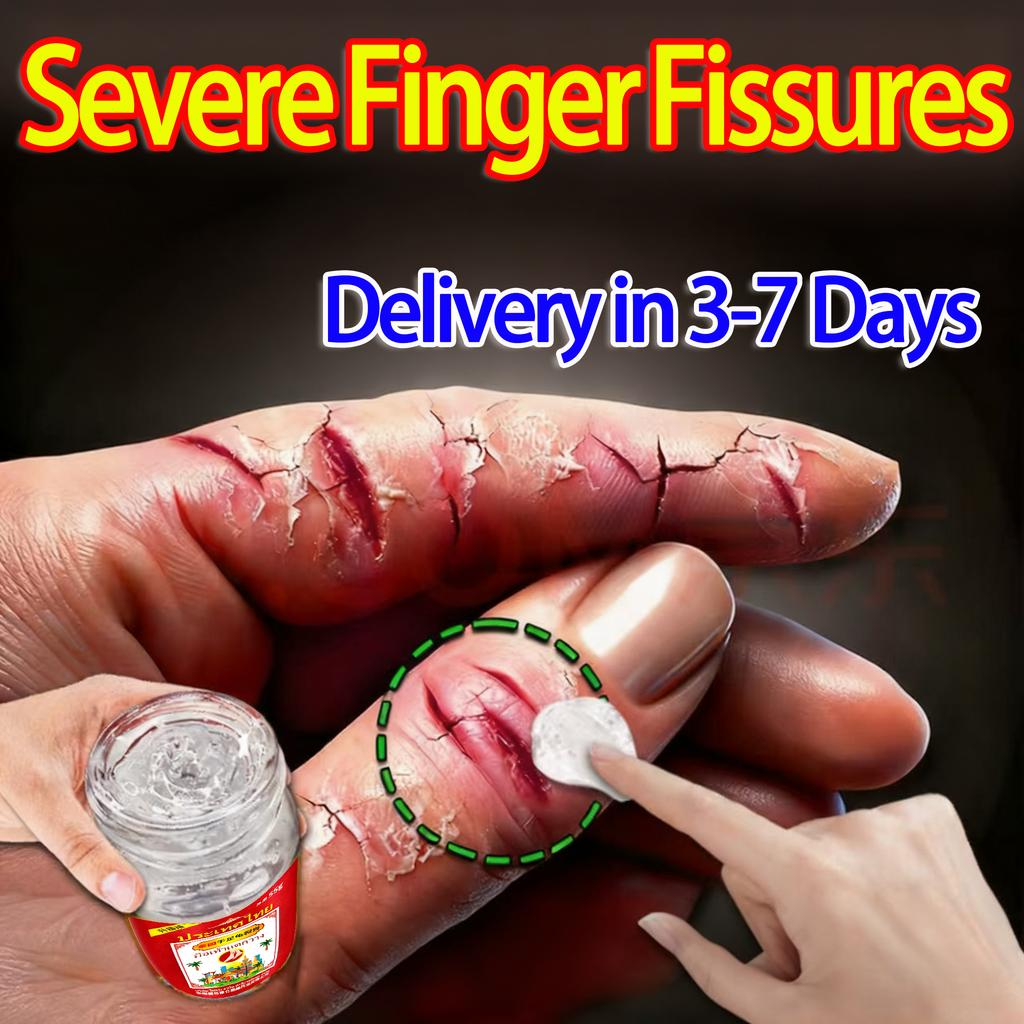 Strong Hand & Foot Fissure Balm - Deeply Nourishing, Soothes Pain