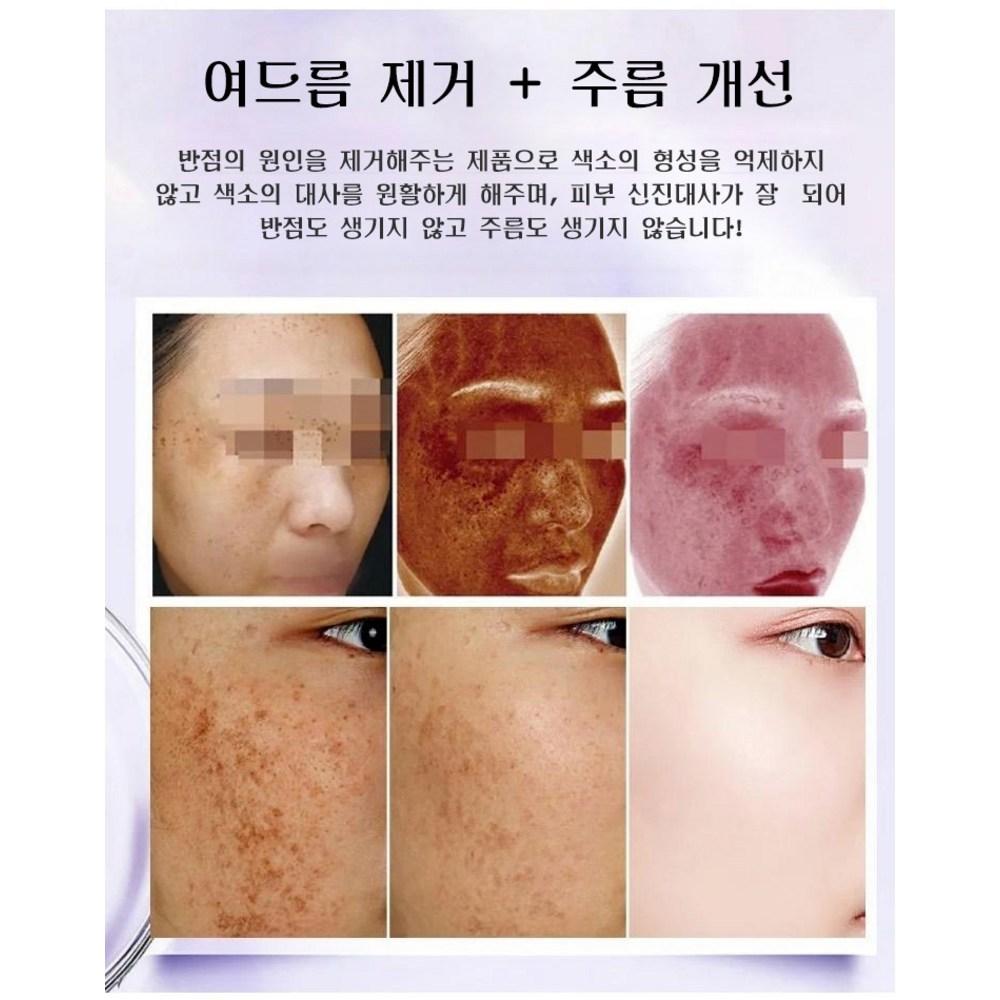 [1/1+1] Brightening Spot Sebum-removing Peel-off Pack, Pore-shrinking, Pure Gold Modeling Pack, 100mlx2