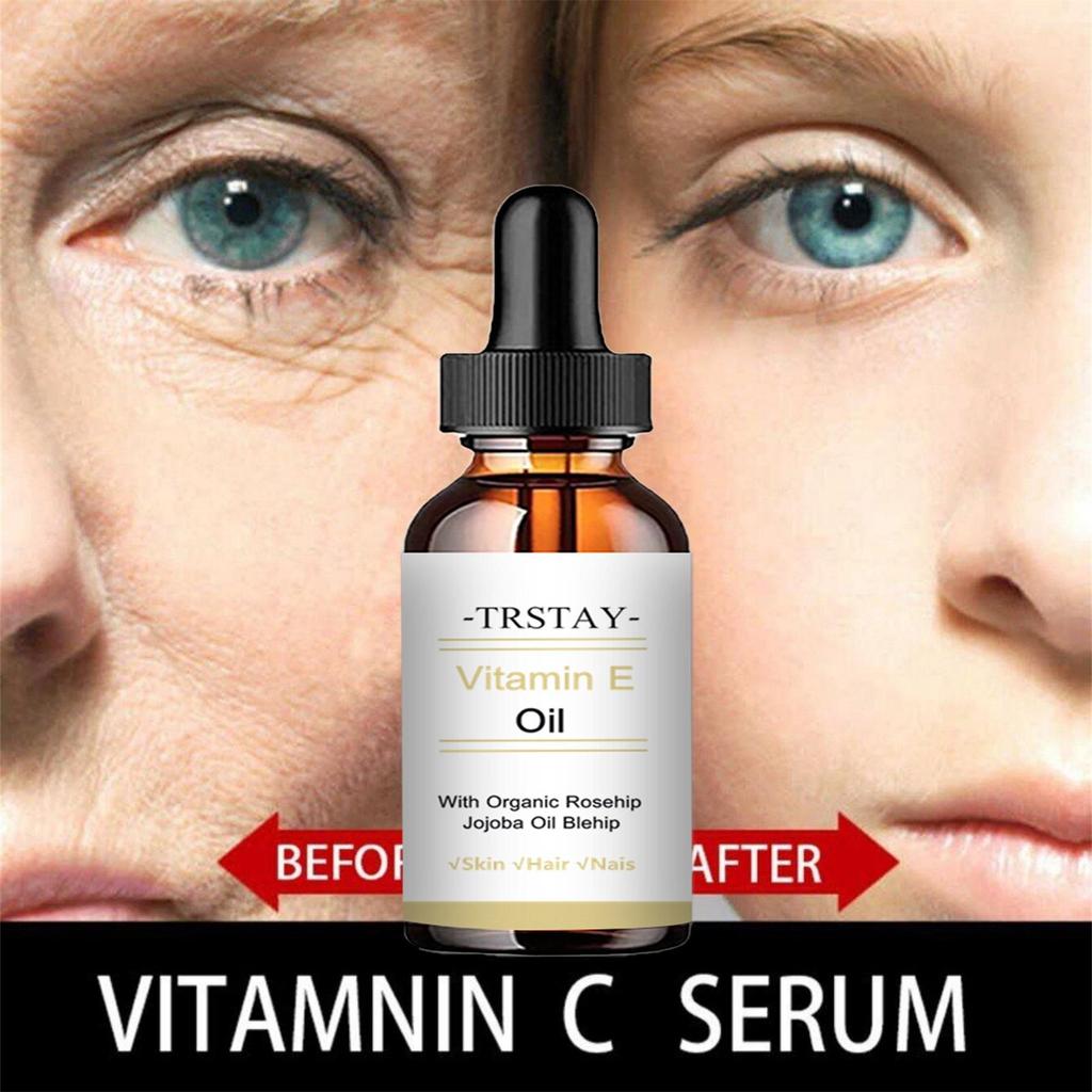 TCA Aid Skin Peel Трихлоруксусная кислота 20% Skin Peel Сокращение пор Морщины Пятна Уход за кожей Сыворотка для лица