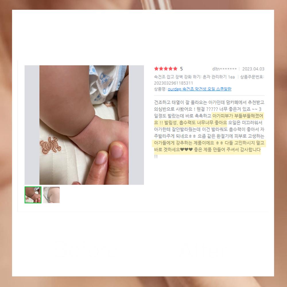 Масло сквалан от экземы для очень сухой кожи, 30 мл, 2 шт.