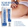 Scar Cream Scar Lightening Smoothing Firming Skin Repair Cream Smoothing Scars