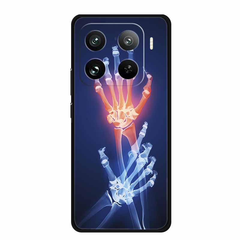 Чехол для телефона Xiaomi 15 S Pro Задняя крышка Чехол Ударопрочный Черный Силикон Мягкий Coque Для Xiaomi 15 15s Pro Чехол 15Pro Funda Оболочка