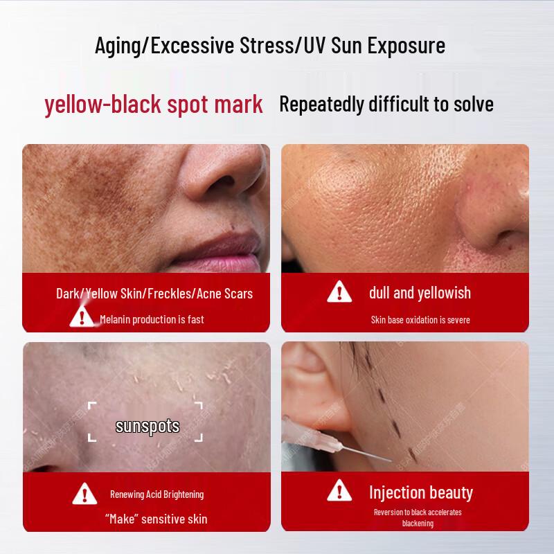 Сыворотка с ниацинамидом для отбеливания и осветления пигментных пятен