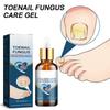 Средство от грибка ногтей на ногах, быстродействующая жидкость для ухода за ногтями от грибка под ногтями и вокруг них, восстанавливает здоровый вид ногтей