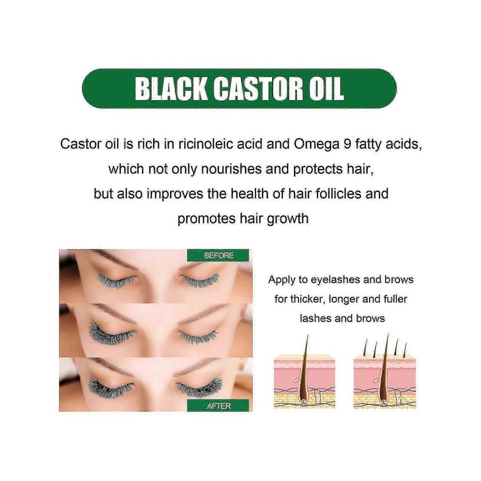 Ouhoe Castor Oil Hair Serum Improves Hairline, Strengthens Hair, Nourishes Hair Roots, Softens Hair And Prevents Hair Loss -jxlgv |  |