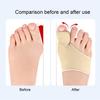 3 пары устройства для коррекции пальцев ног, дышащая ткань, эргономичный корректор пальцев ног, адаптивная посадка, рукав для коррекции косточки