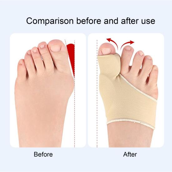 3 пары устройства для коррекции пальцев ног, дышащая ткань, эргономичный корректор пальцев ног, адаптивная посадка, рукав для коррекции косточки