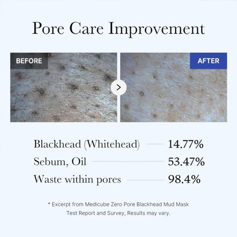 Medicube Грязевая маска Zero Pore от черных точек 100г