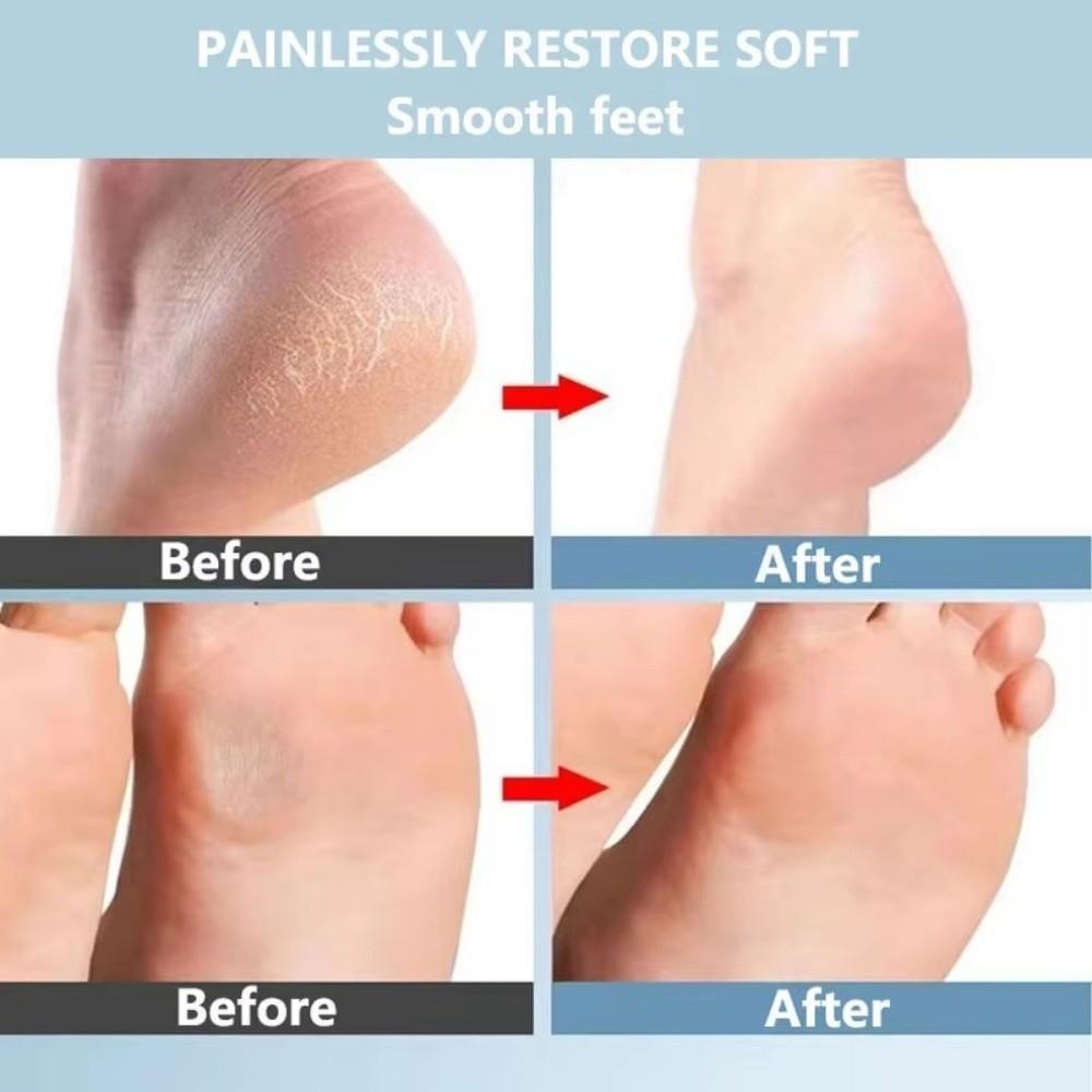 Nanoglass Hand Foot File Oval Scraping Heel Tool Foot Rubbing Board Callus Remover Dead Skin Remover Foot Scrubber