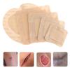 Hydrocolloid Adhesive Dressing Wound Dressing Sterile Bedsore Healing Pad Patch