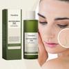 Limited time!!Viareline Moisturizing And Soothing Toner Houttuynia Cordata Facial Toner Soothes The Skin And Rejuvenates It