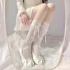 Lady Spring Summer Sweet Bondage Bow Printed Lace Cute Student Calf Socks