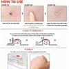 COSRX Acne Pimple Master Patch, 24 шт.