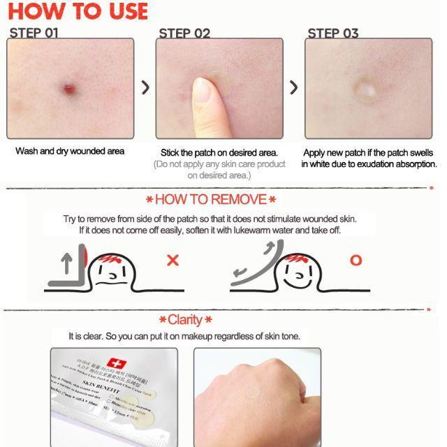 COSRX Acne Pimple Master Patch, 24 шт.