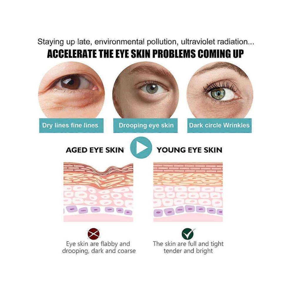 15pcs Instantly Eyes Dark Circle Cream 5pcs/set Anti-Aging Under Eye Cream Remove Eye Bags Puffiness Lift Plump Firm Tighten Eyes Skin