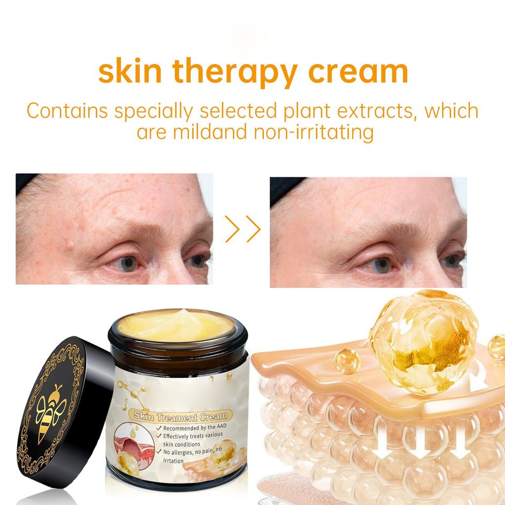 Крем для кожи пчелиного происхождения, крем для кожи пчелиного происхождения, крем для кожи всего тела, натуральный крем для кожи пчелиного происхождения для всех типов кожи