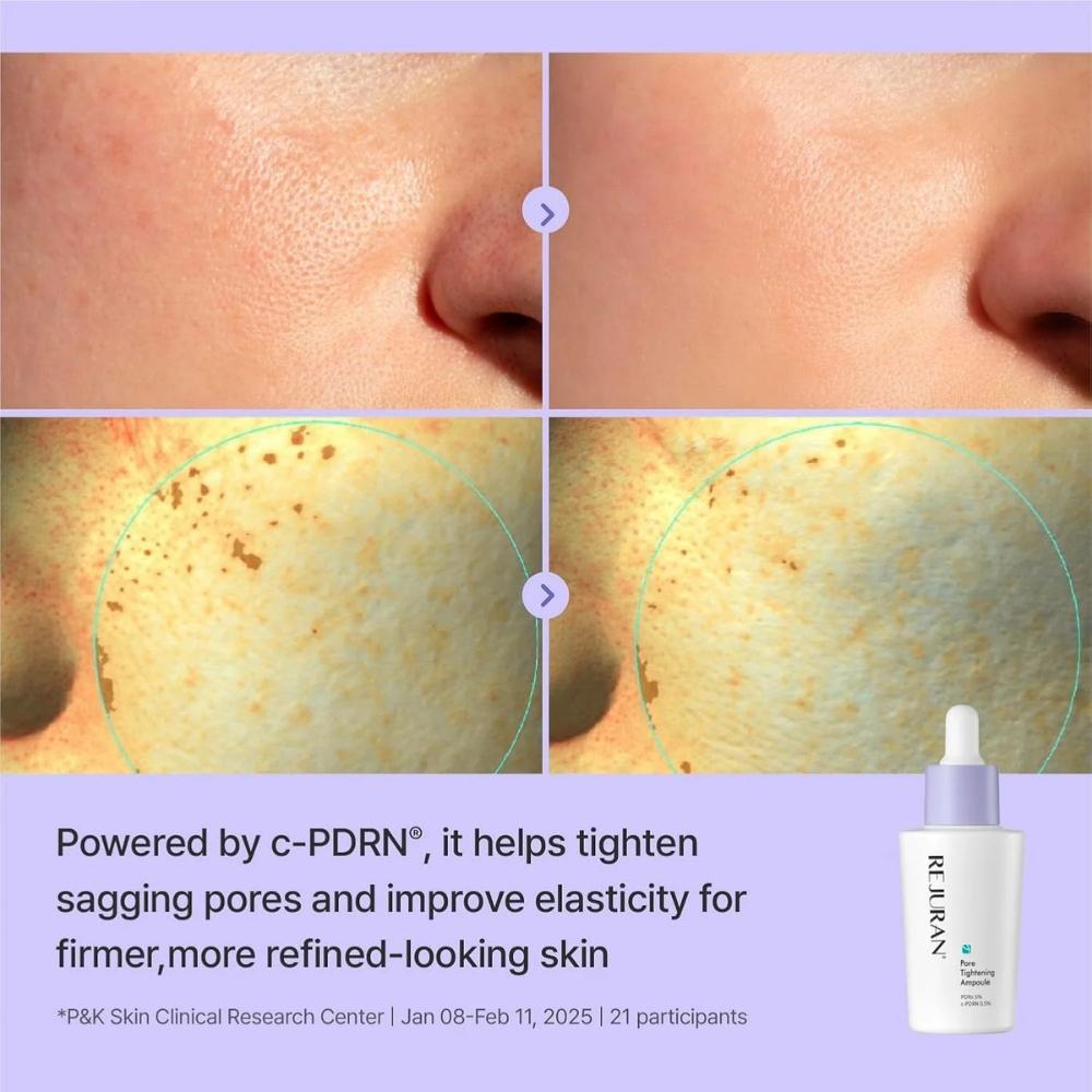 Rejuran Derma Healer Сыворотка для сужения пор 30 мл / 1.01 жидк. унц.. унция
