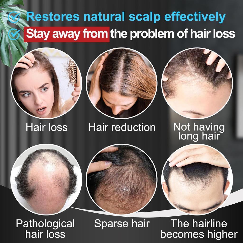 Шампунь с миноксидилом - Уменьшает выпадение волос, Стимулирует рост волос - Стабильный объем волос и здоровое состояние - Подходит для всех типов волос, 200 мл