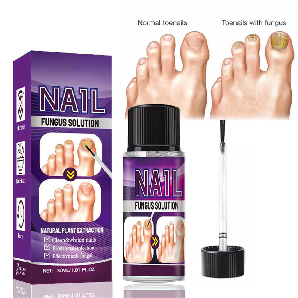 Toenail Fungus Care, быстродействующая жидкость для ухода за ногтями от грибка под и вокруг, восстанавливает здоровый вид ногтей 30 мл