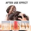 For Boost Hair Serum For Hair Growth Thickening Nourishing Scalp Treatment With Polygonum Multifloru