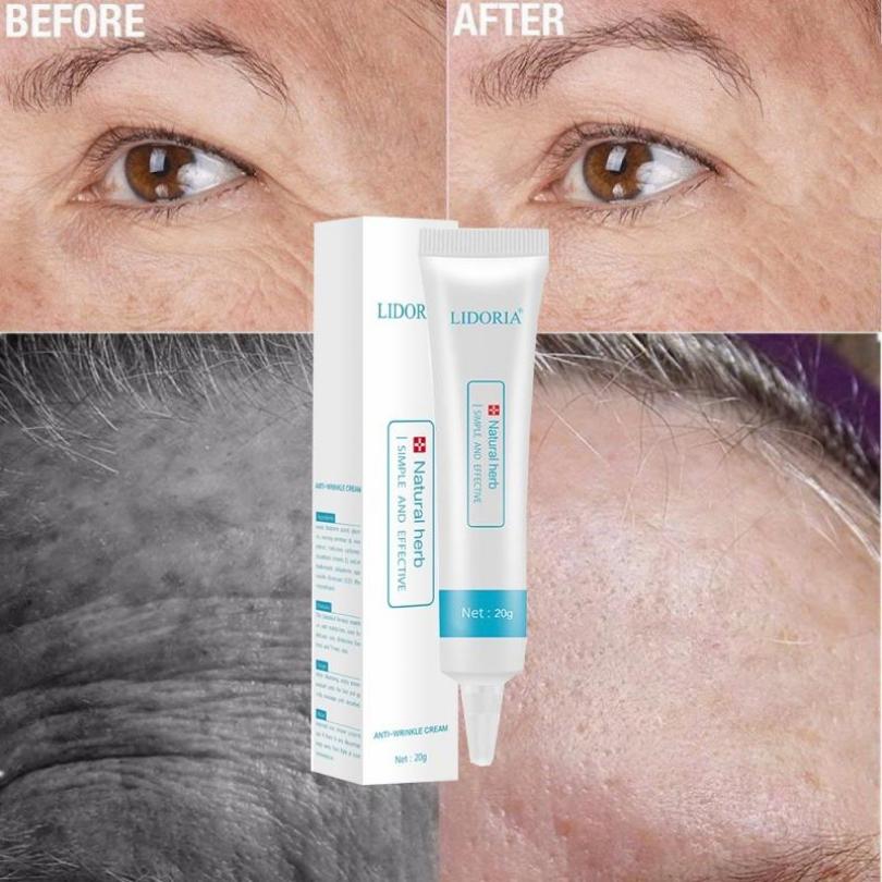 1PC 20G Травяной антивозрастной крем для лица, уменьшающий морщины и тонкие линии, дневной и ночной крем для глаз Beauty