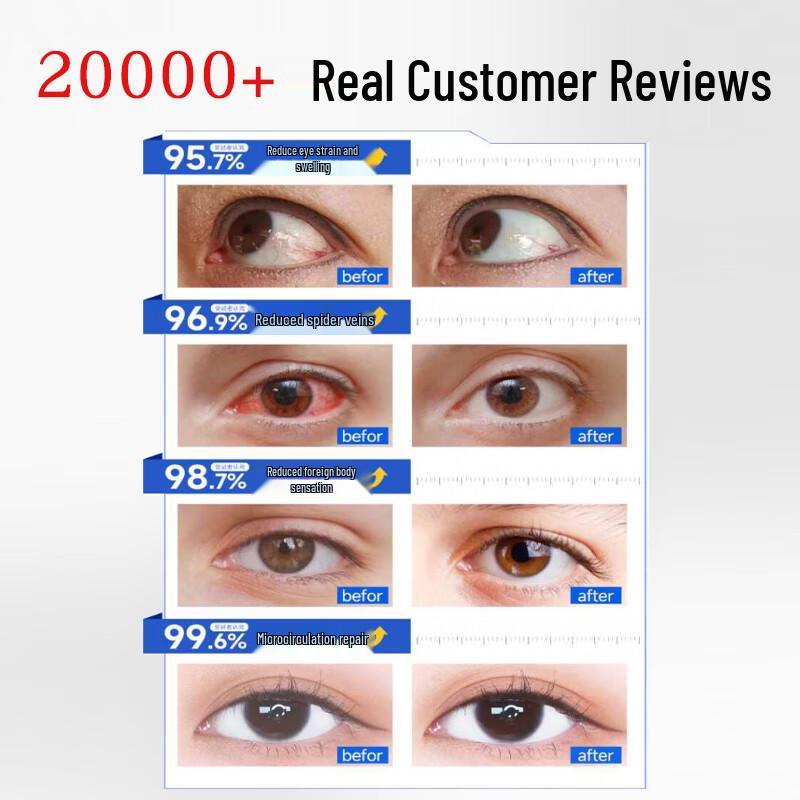 Lutein Eye Drops