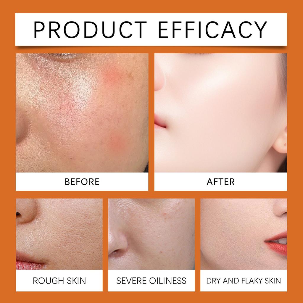 Bee Skin Stick Removal Of Skin Tag Spots, Firming Skin Gentle Ingredients