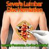 Therapeutic Medicated Plaster for Lumbar Disc Herniation