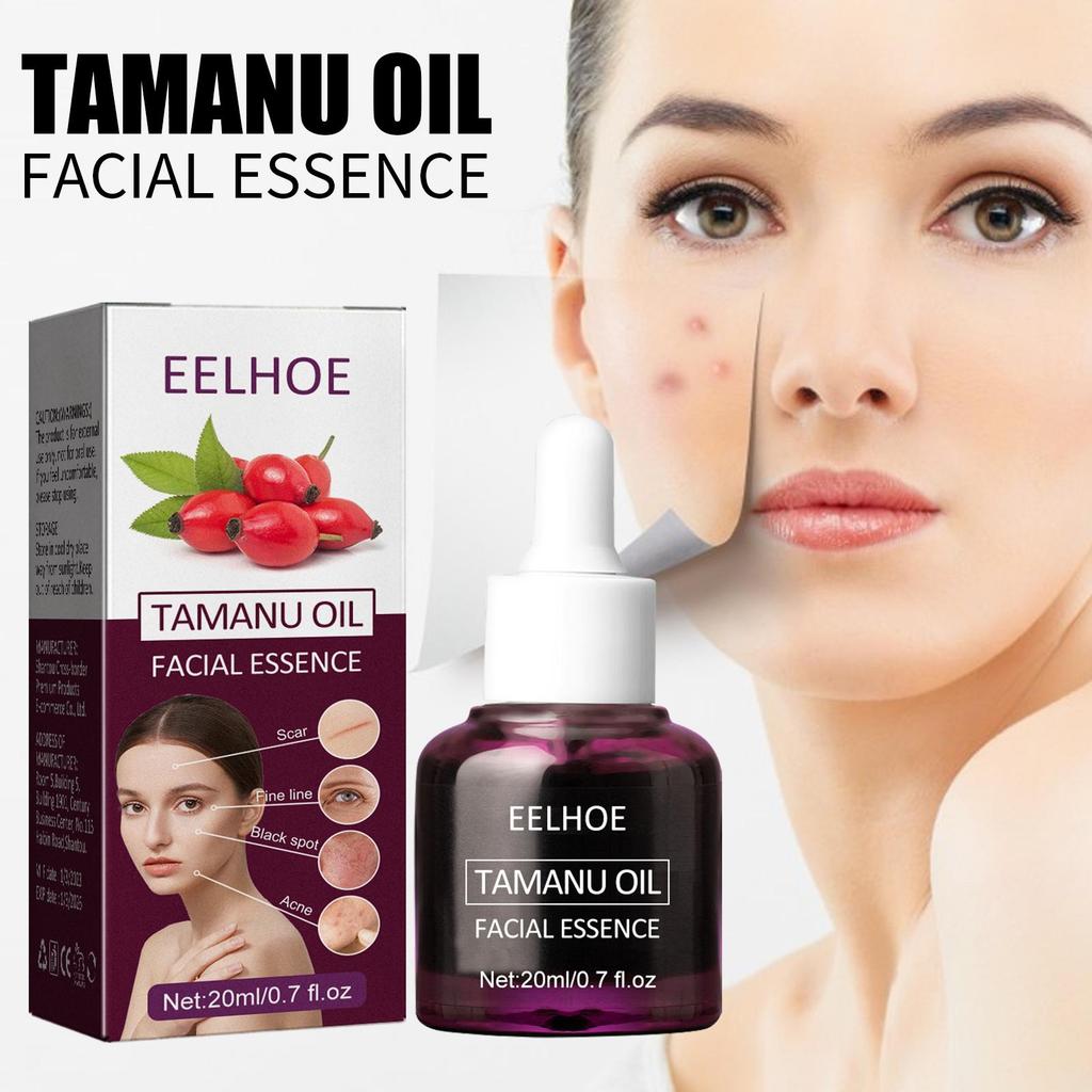 EELHOE Масло для лица «Бегония» уменьшает следы от прыщей, осветляет морщины, увлажняет и укрепляет кожу. Эфирное масло