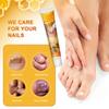 Nail Cream, Cleans And Smoothes Nails, Repairs Damaged Nails, Strengthens Nails, Promotes Nail Health, Nourishes And Moisturizes The Skin