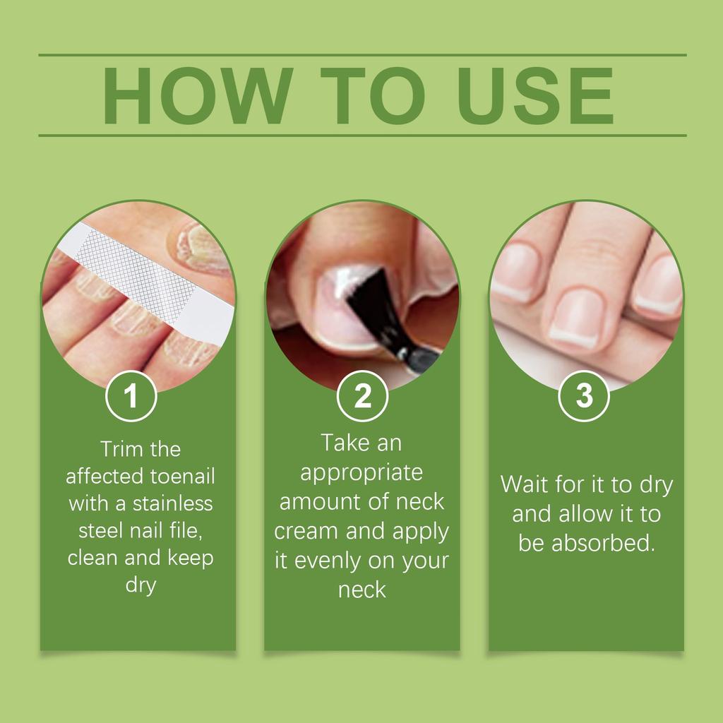 Toenail Fungus TreatmentExtra Strong, NailTreatment, Nail Care TreatmentExtra Strong For Thick, Discolored And Damaged Nails,30ml