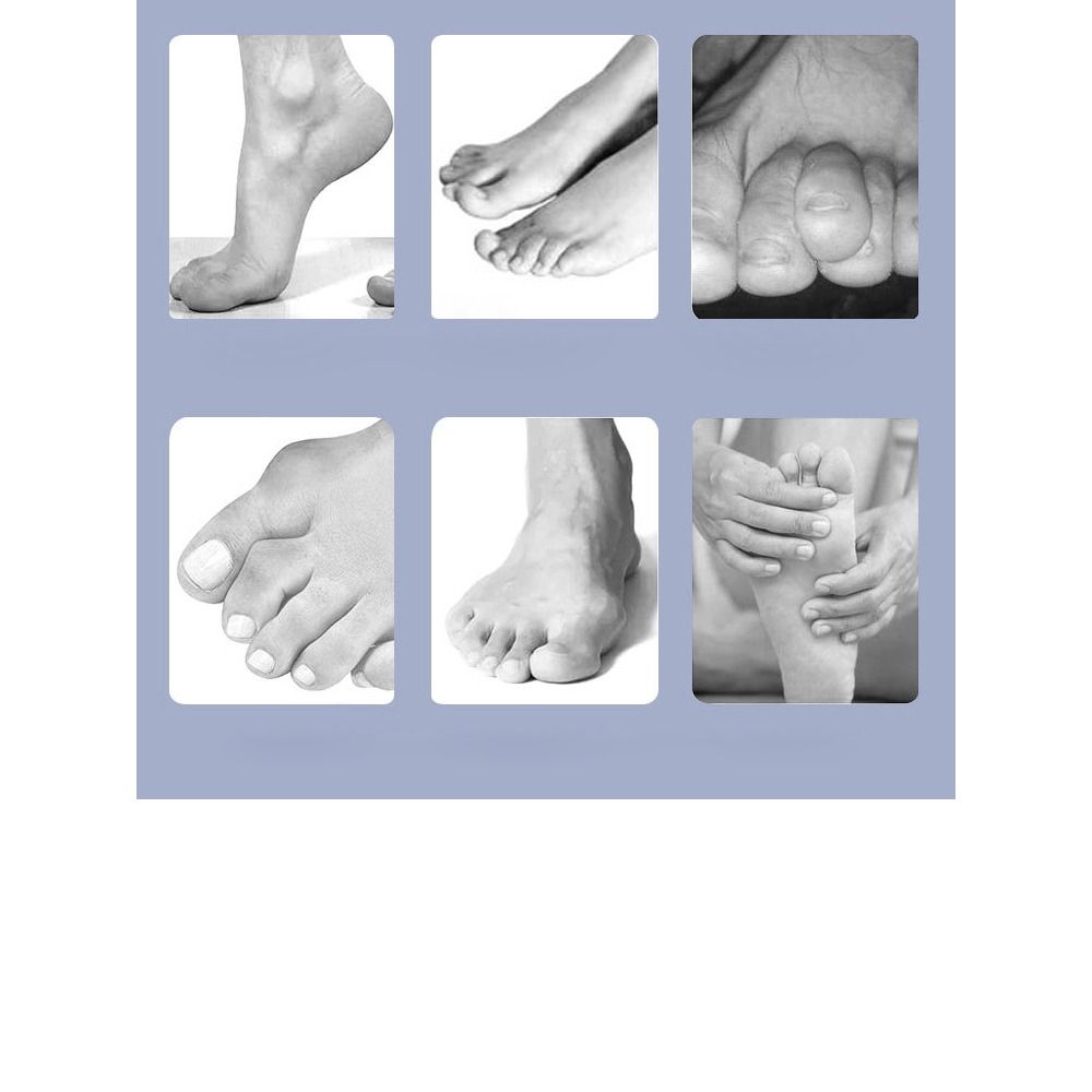 Поддерживающий ремешок для пальцев ног Мягкий фиксатор пальцев ног Фиксирующий зажим Фиксатор Поддержка стопы Мужчины Женщины